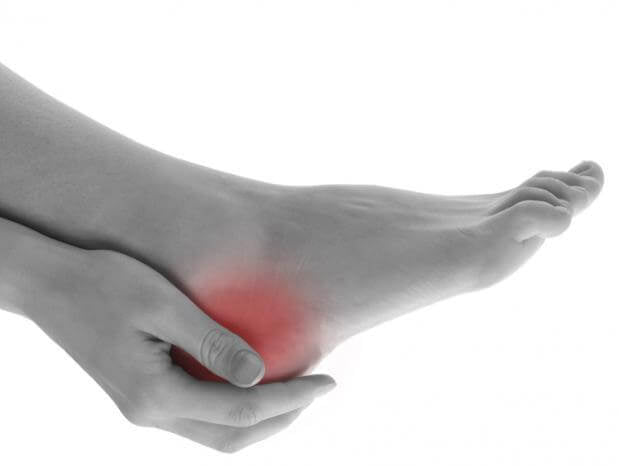 Heel pain - plantar fasciitis - Alkaline World
