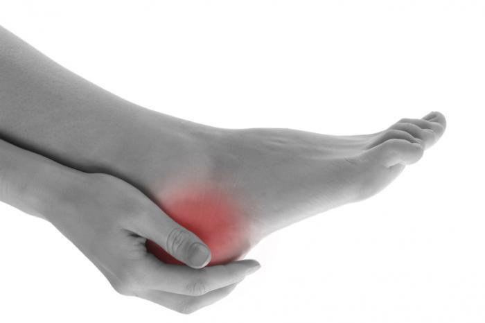 Heel pain - plantar fasciitis - Alkaline World