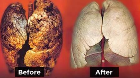 How To Purify Your Lungs In 72 Hours - Alkaline World