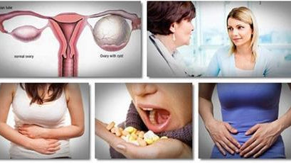 How to Treat Ovarian Cysts Naturally and What Are the Symtoms - Alkaline World