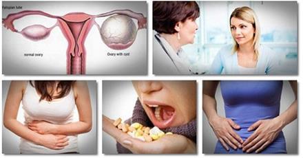 How to Treat Ovarian Cysts Naturally and What Are the Symtoms - Alkaline World